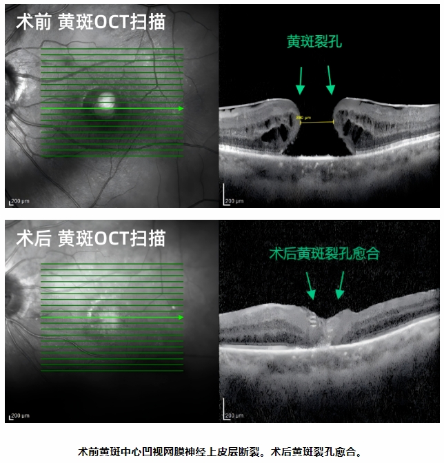 微信截图_20241209084613.png